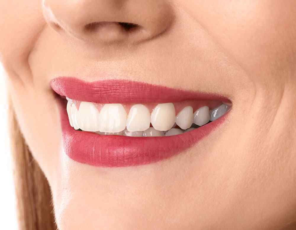 smile makeover dental clinic east village