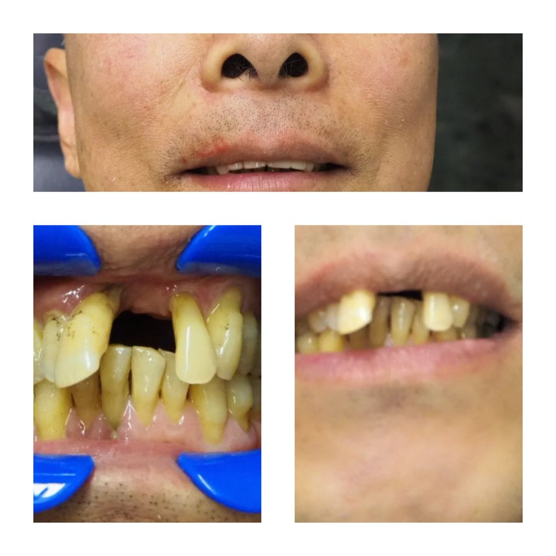 best smile makeover dentist east village