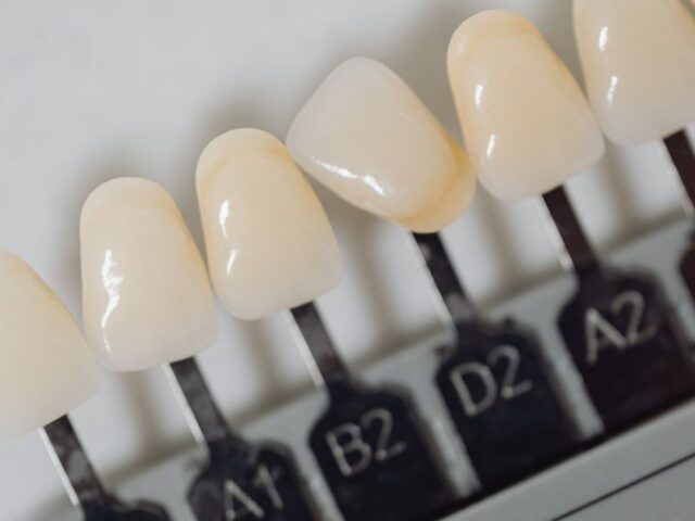 Teeth Names and Functions