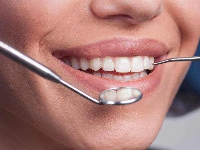 How Cosmetic Dentistry Can Fix Gaps, Chips & Uneven Teeth