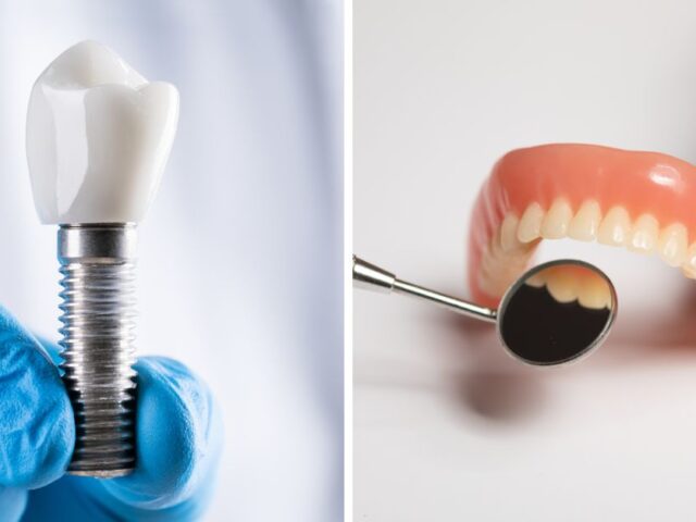 Dental Implants vs Dentures: Which Is the Better Long-Term Solution?