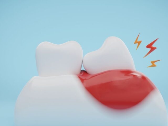 What to Do If Your Gums Are Swollen and Painful