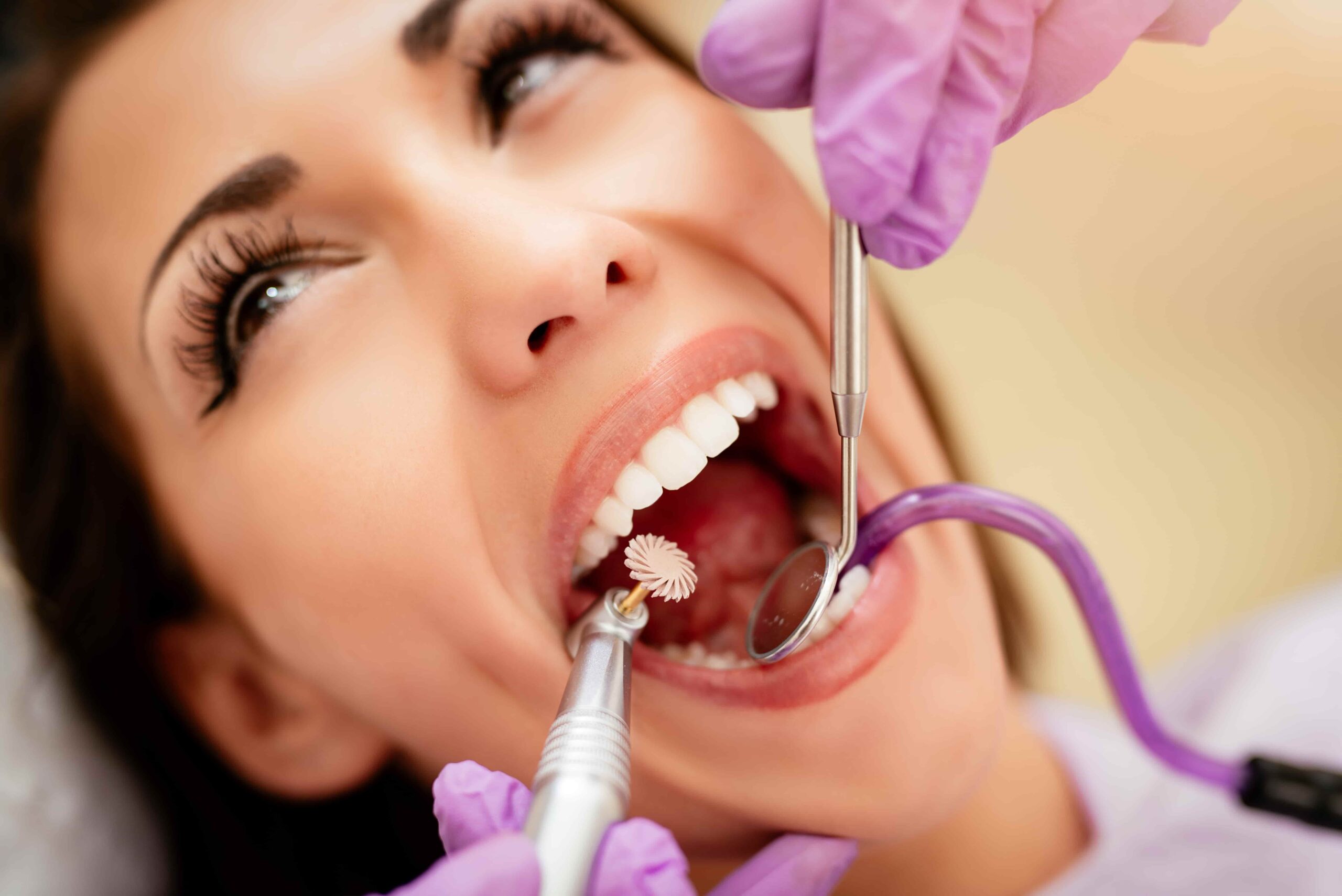 Professional teeth cleaning and exam