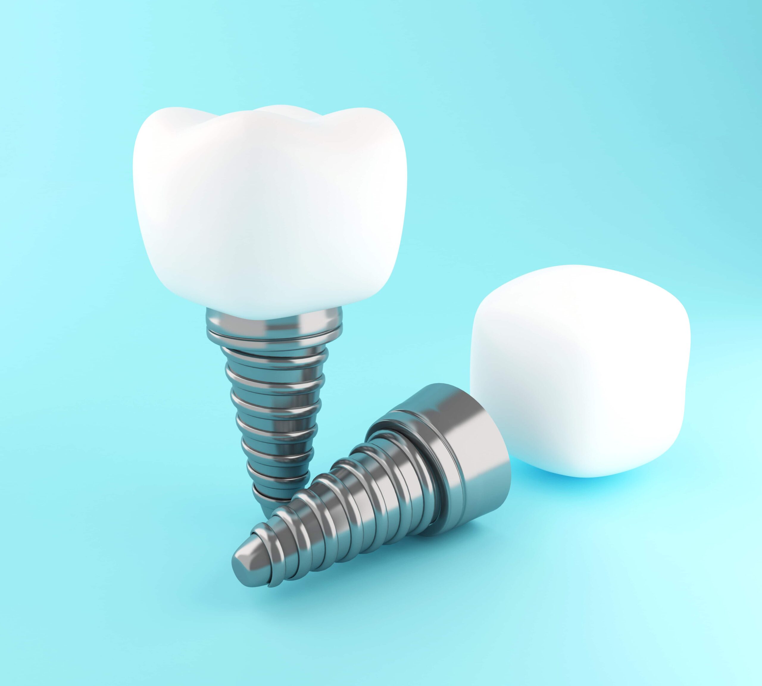 Dental implants on a light blue background