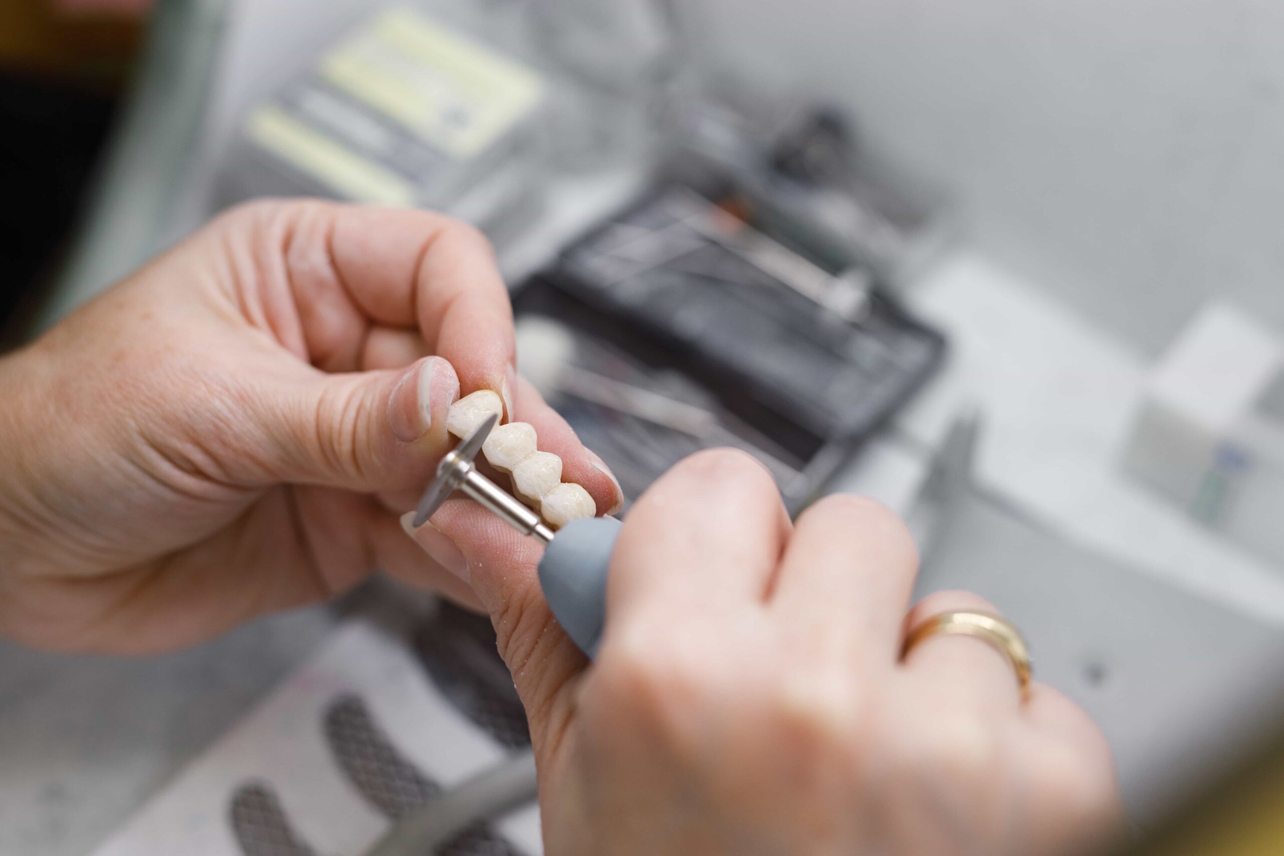Dental technician working on a prosthetic bridge